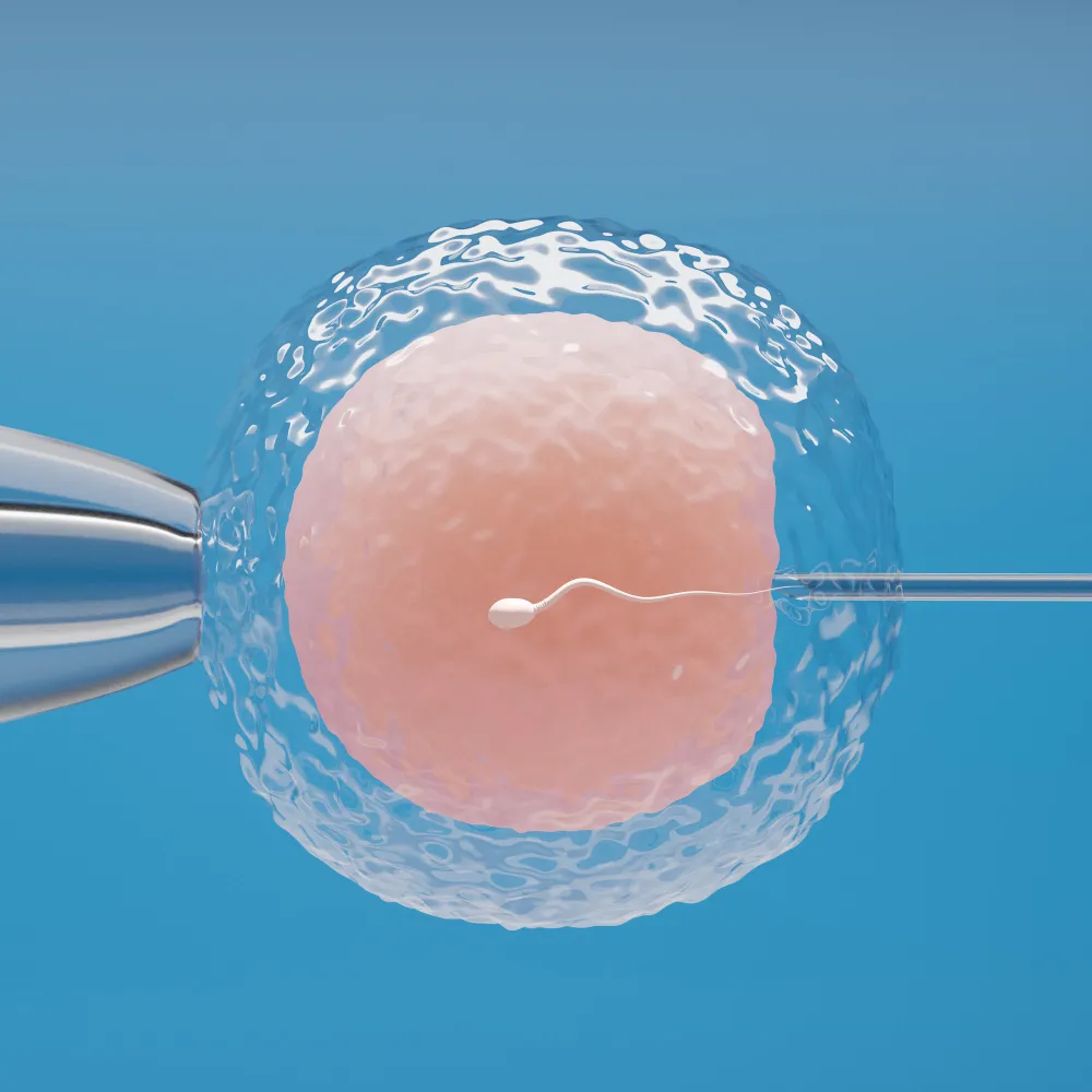 MACS Sperm