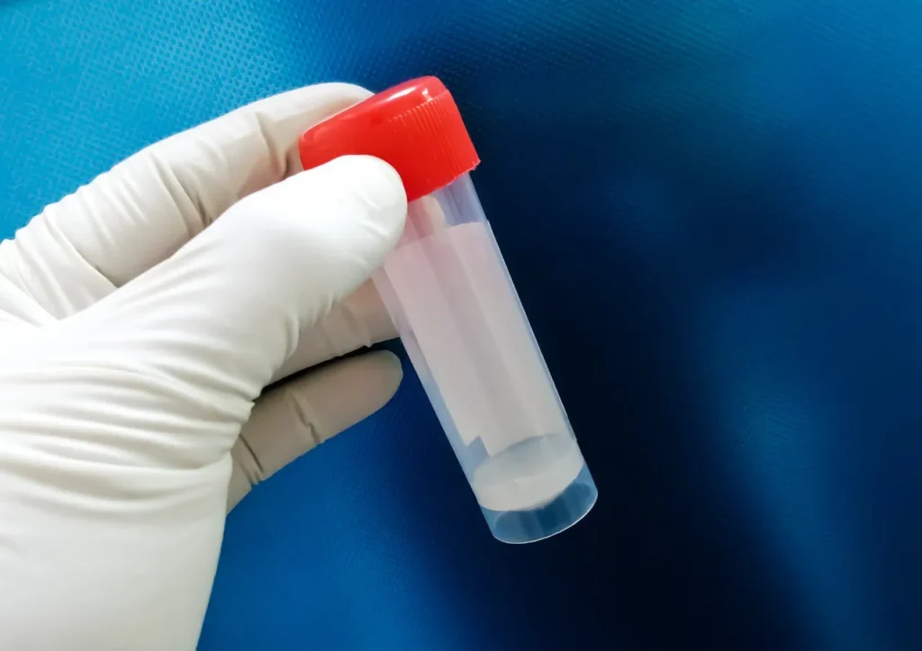 Sperm Retrieval from Epididymal Sperm Aspiration (PESA)